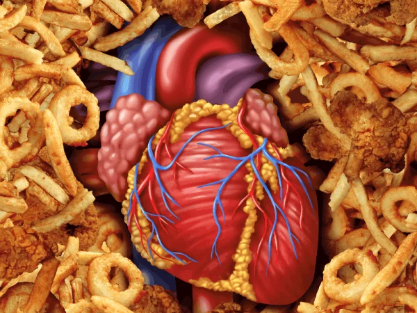 Ungesunde Lebensmittel Transfette konsumieren Pommes Fleisch im Oel gebraten Herzinfarkt verursachen